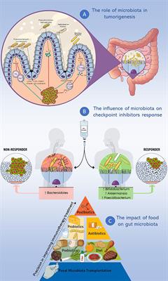 The Challenge of ICIs Resistance in Solid Tumours: Could Microbiota and Its Diversity Be Our Secret Weapon?